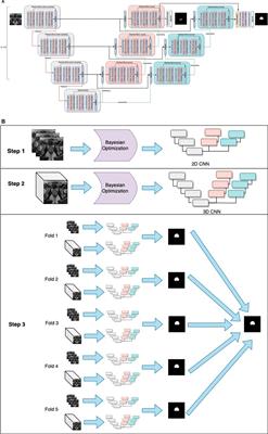 A multi-object deep neural network architecture to detect prostate anatomy in T2-weighted MRI: Performance evaluation